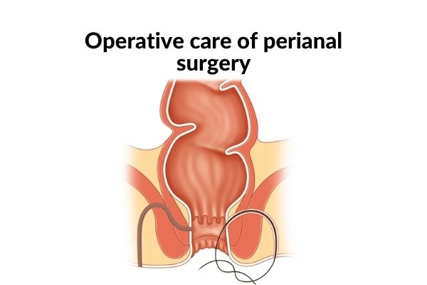 Post Operative Care Of Perianal Surgery